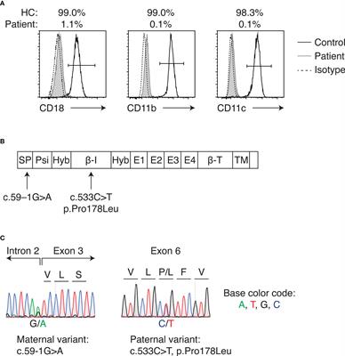 Case report: HLA-haploidentical hematopoietic cell transplant with posttransplant cyclophosphamide in a patient with leukocyte adhesion deficiency type I